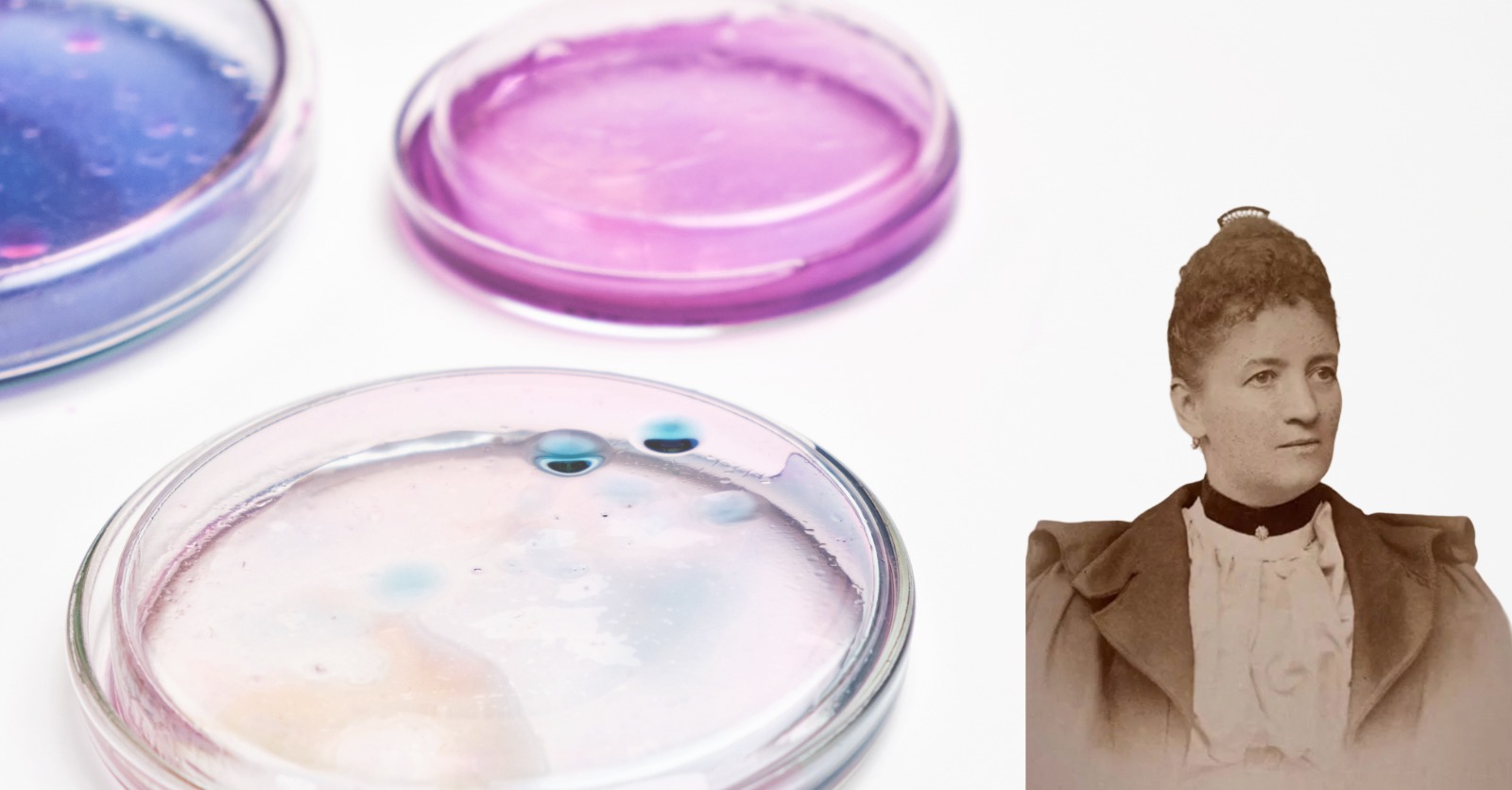 fanny hesse culture media